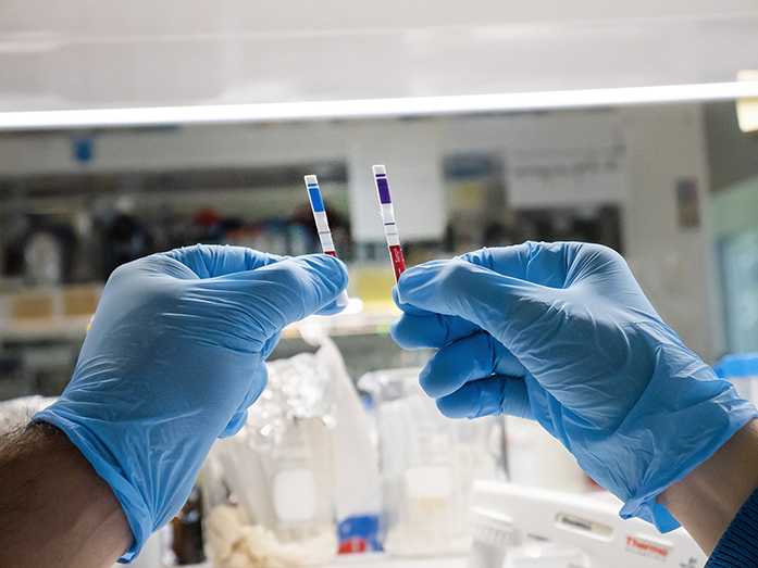 COVID-19: hacia el primer test de antígenos 100 % argentino